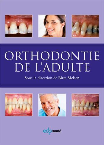 Couverture du livre « Orthodontie de l'adulte » de Birte Melsen aux éditions Parresia