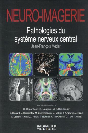 Couverture du livre « Neuro-imagerie : pathologies du système nerveux central (2e édition) » de Jean-Francois Meder et Collectif aux éditions Sauramps Medical