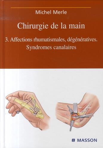 Couverture du livre « Chirurgie de la main t.3 ; affections rhumatismales, dégénératives. syndrome canalaire » de Michel Merle aux éditions Elsevier-masson
