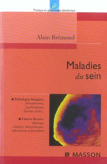 Couverture du livre « Maladies du sein ; pathologies benignes ; cancers du sein » de Alain Bremond aux éditions Elsevier-masson