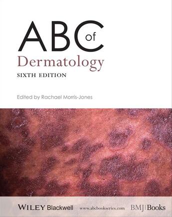 Couverture du livre « ABC of Dermatology » de Rachael Morris-Jones aux éditions Bmj Books
