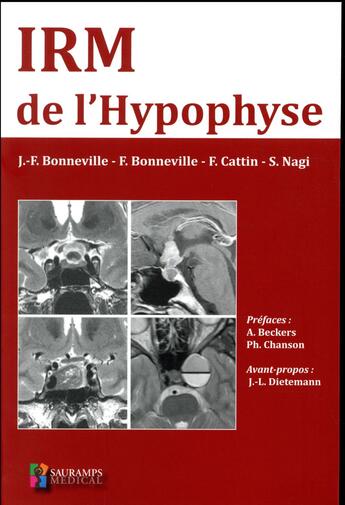 Couverture du livre « IRM de l'hypophyse » de Jf Bonneville aux éditions Sauramps Medical