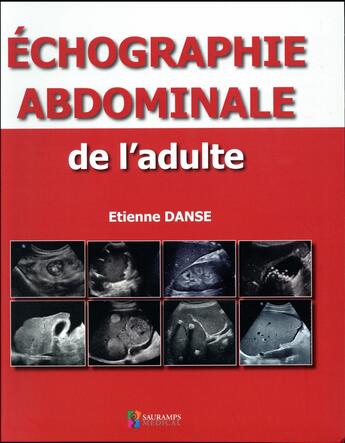 Couverture du livre « Échographie abdominale de l'adulte » de Danse Etienne aux éditions Sauramps Medical