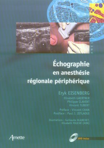 Couverture du livre « Échographie en anesthésie régionale » de Arnette aux éditions Arnette