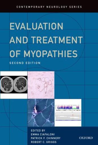 Couverture du livre « Evaluation and Treatment of Myopathies » de Chinnery Patrick aux éditions Oxford University Press Usa