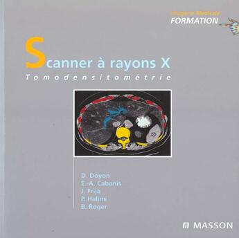 Couverture du livre « Scanner a rayons x » de Dominique Doyon aux éditions Elsevier-masson
