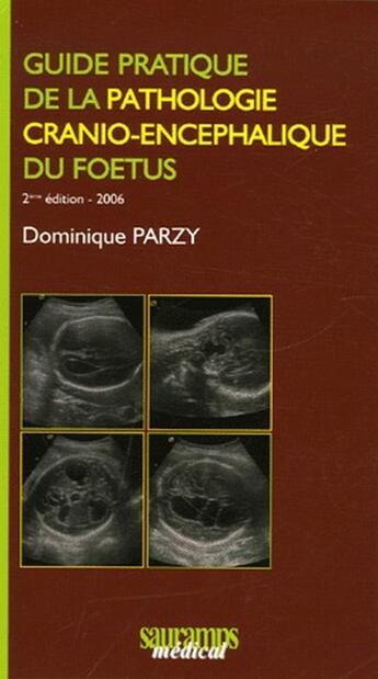 Couverture du livre « Guide pratique de la pathologie cranio-encephalique du foetus (2e édition) » de Parzy Dominique aux éditions Sauramps Medical