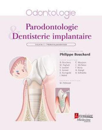 Couverture du livre « Parodontologie et dentisterie implantaire Tome 1 ; médecine parodontale » de Philippe Bouchard aux éditions Lavoisier Medecine Sciences