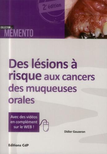 Couverture du livre « Des lésions à risque aux cancers des muqueuses orales » de Didier Gauzeran aux éditions Cahiers De Protheses