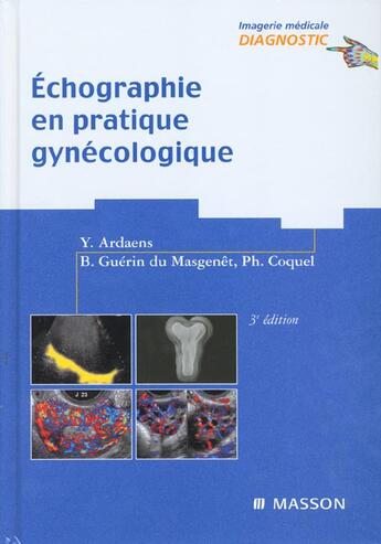 Couverture du livre « Echographie En Pratique Gynecologique ; 3e Edition » de Philippe Coquel et Yves Ardaens et Bernard Guerin Du Masgenet aux éditions Elsevier-masson