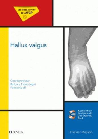 Couverture du livre « Hallux valgus ; mises au point de l'AFCP » de  aux éditions Elsevier-masson