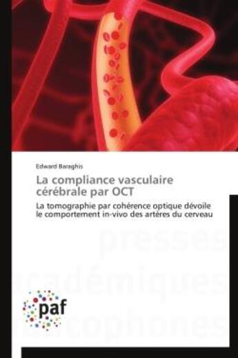Couverture du livre « La compliance vasculaire cérébrale par OCT » de Edward Baraghis aux éditions Presses Academiques Francophones