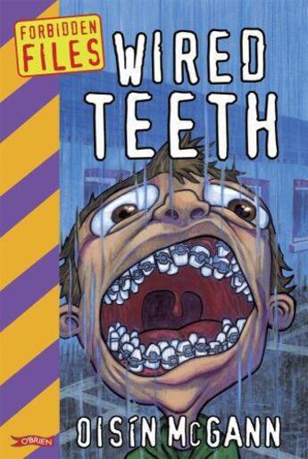 Couverture du livre « Wired Teeth » de Mcgann Oisin aux éditions The O'brien Press Digital