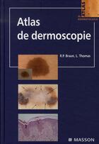 Couverture du livre « Atlas de dermoscopie » de Braun+Thomas aux éditions Elsevier-masson