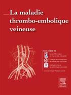 Couverture du livre « La maladie thromboembolique veineuse » de Philippe Lacroix et Collectif aux éditions Elsevier-masson